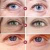 Anti Wrinkle Eye Bag Remover Cream