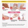 Dead Skin Remover Crack Cream