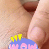 Dead Skin Remover Crack Cream