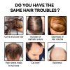 Eelhoe Ball Bearing Dense Hair Essential Oil For Scalp Care