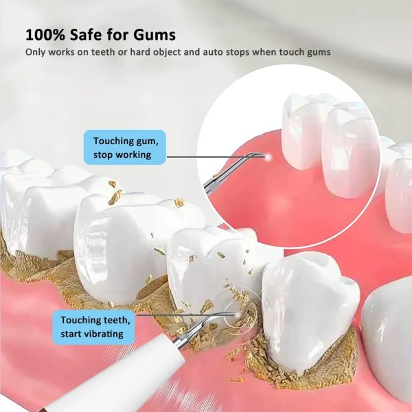 Electric Dental Calculus Remover