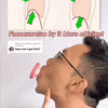 Face Lifter Massager