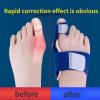Flexfix Toe Splint