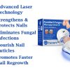 Fungus Laser Therapy Device