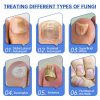 Fungus Laser Therapy Device