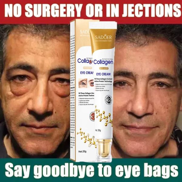 Instant Eye Bag Removal