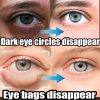 Instant Eye Bag Removal