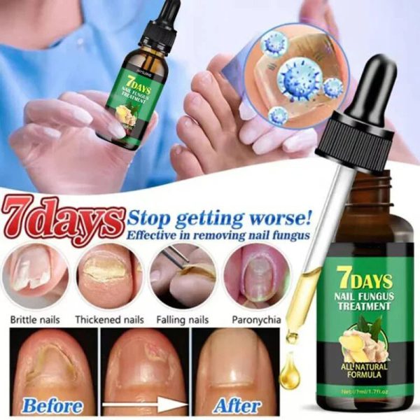 Nail Fungus Defender Serum
