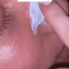 Nose Pore Strip Blackhead Remover