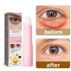 Retinol Eye Cream Instant Removing Eyes Wrinkle