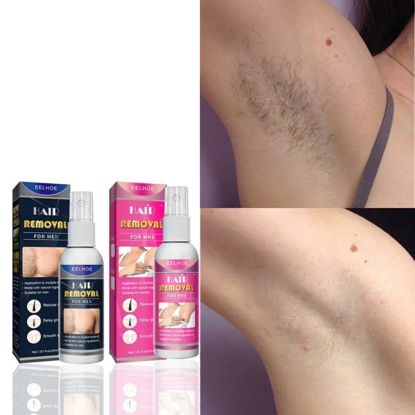 Semi-Permanent Hair Removal Spray