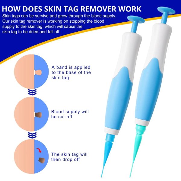 Skin Tag Removal Kit