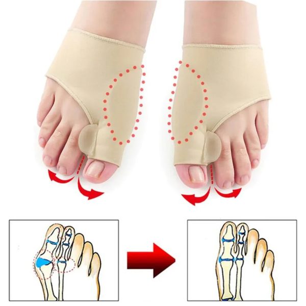 Toe Valgus Corrective Socks