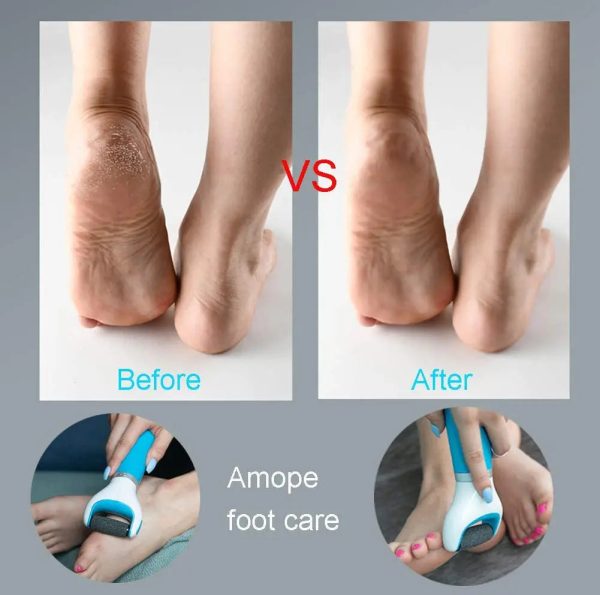 Usb Foot Callus Remover Pedicure Tool