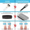 Usb Foot Callus Remover Pedicure Tool