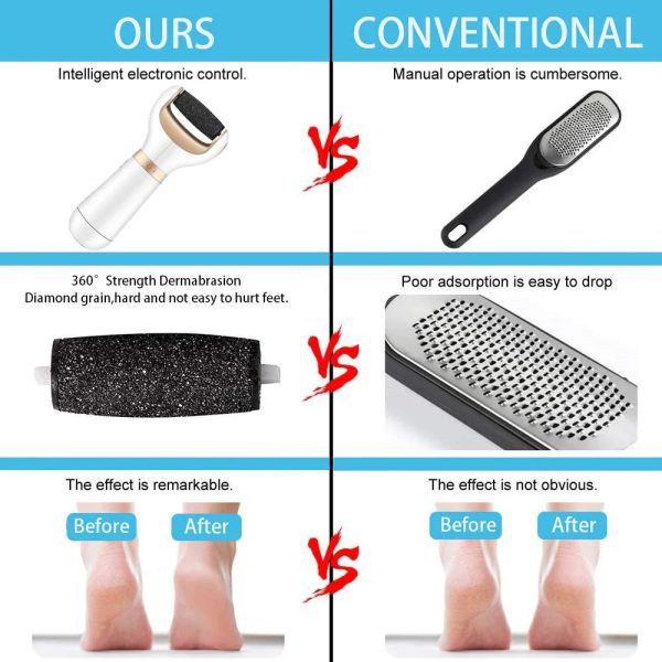 Usb Foot Callus Remover Pedicure Tool
