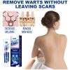 Wart Remover Cream Fast & Effective