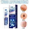 Wart Remover Cream Fast & Effective